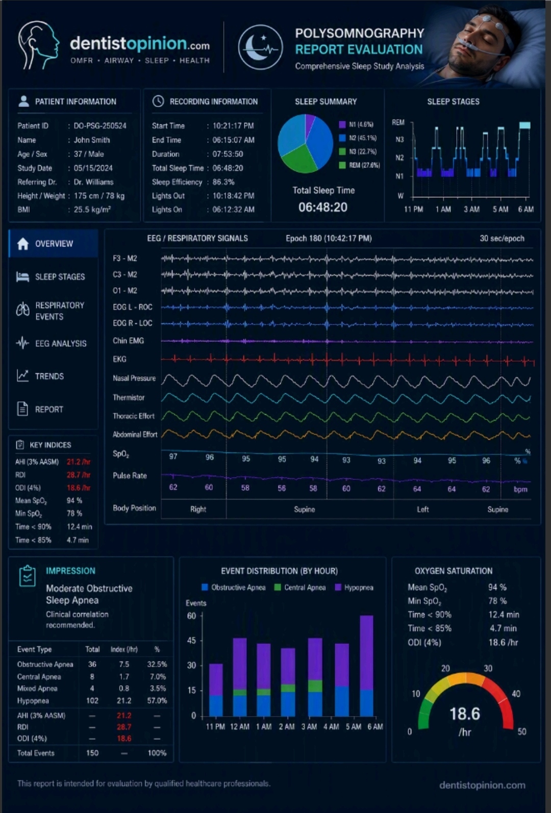 Polysomnography Report Evaluation